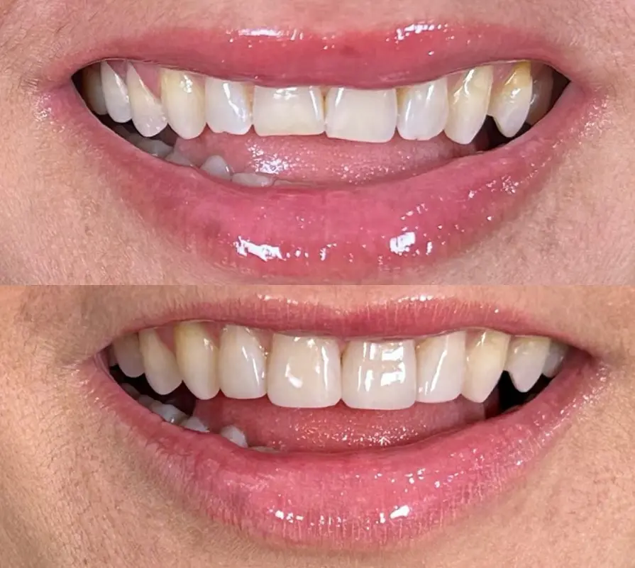 Antes e depois de tratamento odontológico
